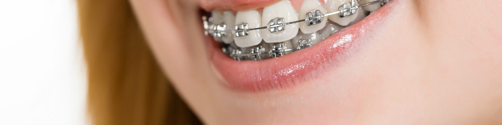 orthodontics