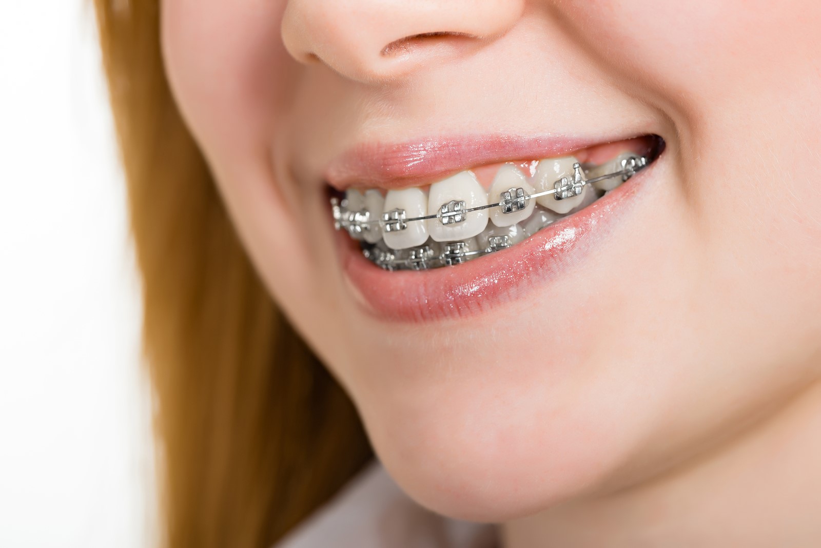 Braces & Beyond: The Future of Orthodontics Unveiled