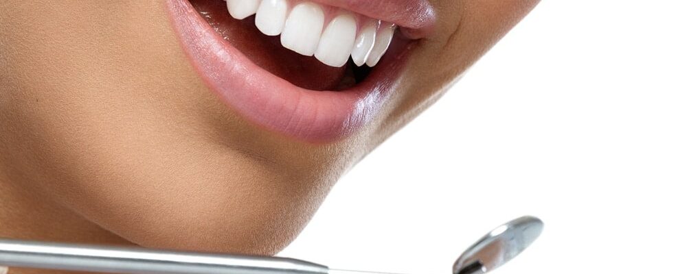 tooth whitening